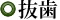 抜歯
